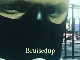 Bruisedup